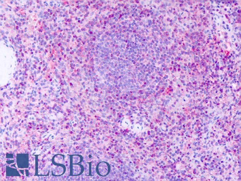 IHC-plus™ GPR63 Antibody (Extracellular Domain)