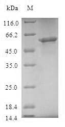 Human TOMM40 / TOM40 Protein (Recombinant GST, N-terminus)