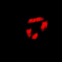 BRCA1 Antibody (C-Terminus)