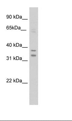 Polyclonal Rabbit anti-Mouse NR1I3 / CAR Antibody (C-Terminus, IHC, WB)