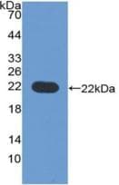 Human CD276 / B7-H3 Protein (Recombinant His, N-Terminal)