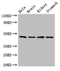 NOB1 / NOB1P Antibody