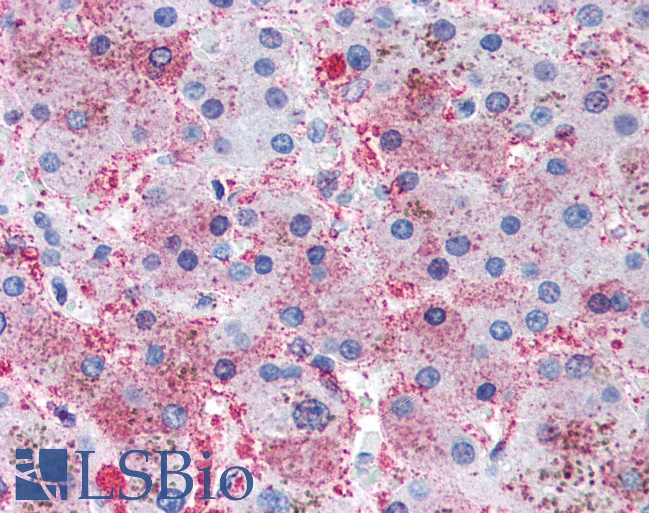 IHC-plus™ AK3 / Adenylate Kinase 3 Antibody (clone SJB3-36)