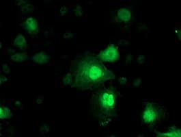 IHC-plus™ NNMT Antibody (clone 3D8)