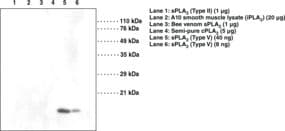 IHC-plus™ PLA2G5 Antibody (clone MCL-3G1)