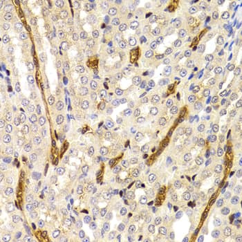 PARD6A / PAR6 Antibody