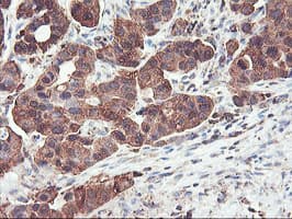 PFKP Antibody (clone OTI1D6)