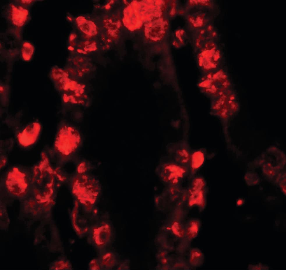 IHC-plus™ STAT3 Antibody