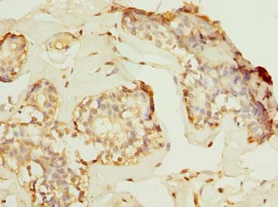 HPCAL1 / Hippocalcin-Like 1 Antibody