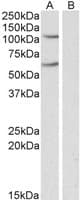 IHC-plus™ Polyclonal Goat anti-Human IREB2 / IRP2 Antibody (aa489-503, IHC, WB)