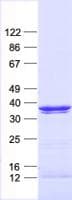 Human CASP6 / Caspase 6 Protein (Recombinant His, N-Terminal)