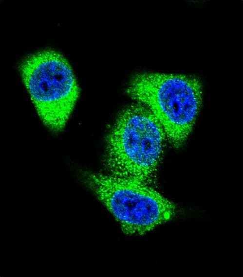 TOP2A / Topoisomerase II Alpha Antibody (aa1167-1196)