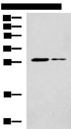 POMC / Proopiomelanocortin Antibody