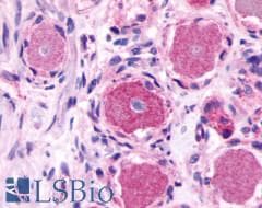PathPlus™ Polyclonal Rabbit anti-Human MRGPRE / MRGE Antibody (C-Terminus, IHC)