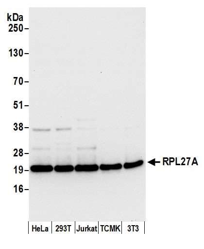Polyclonal Rabbit anti-Human RPL27A Antibody (aa1-50, WB)