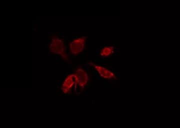 Polyclonal Rabbit anti-Human CCR9 / CD199 Antibody (WB)