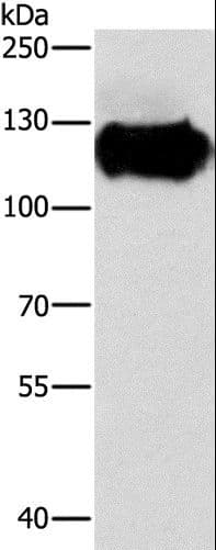 Polyclonal Rabbit anti-Human CAST / Calpastatin Antibody (IHC, WB)