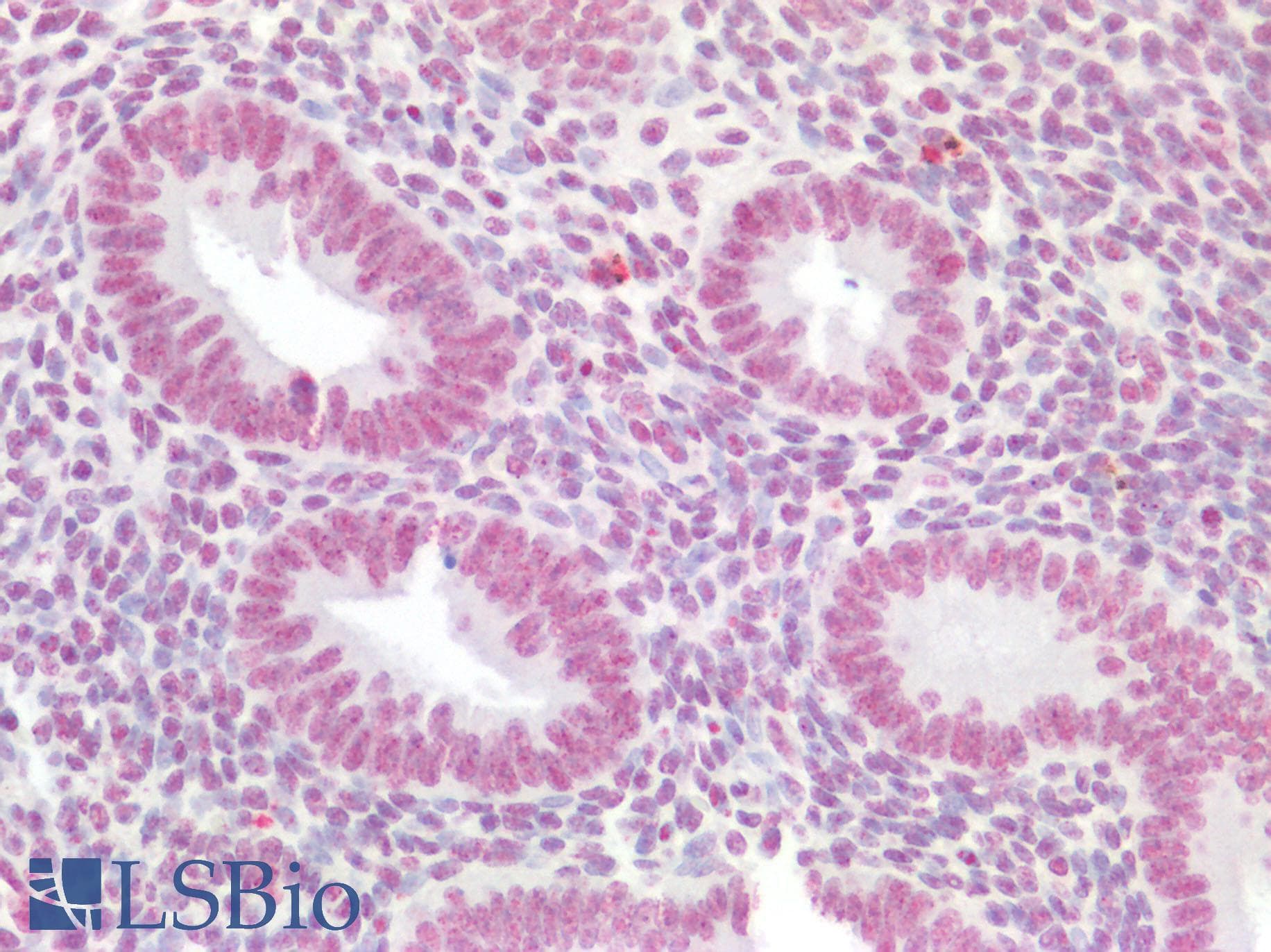 Monoclonal Mouse anti-Human HOXA9 Antibody (clone 2A11-2D2, IHC, IF, WB)