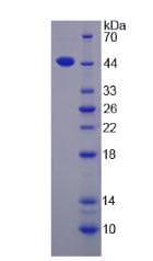 Human IL17D Protein (Recombinant His-GST, N-terminus)