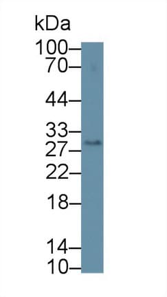 CD209 / DC-SIGN Antibody (aa115-238, APC)