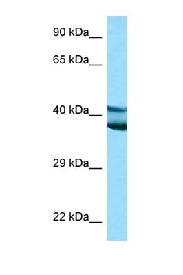 LYAR Antibody (aa81-130)