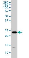 IHC-plus™ Monoclonal Mouse anti-Human PSMD10 / Gankyrin Antibody (clone 4B5, IHC, IF, WB)