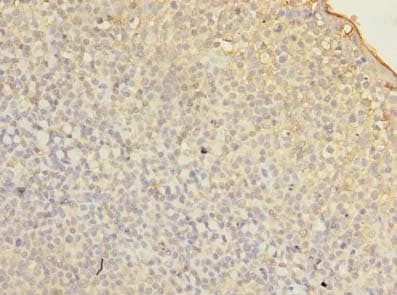 FMNL1 Antibody