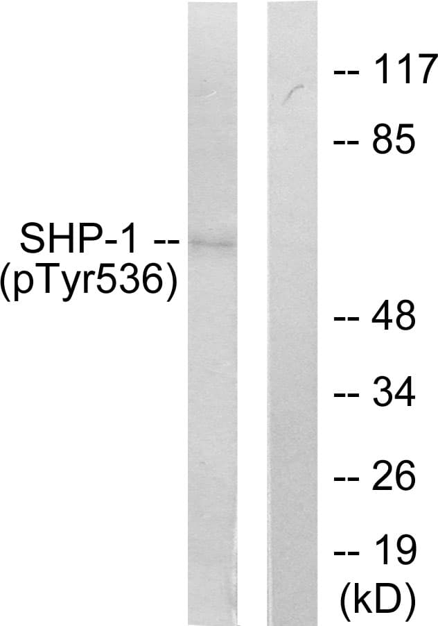 PTPN6 / SHP1 Antibody (phospho-Tyr536)
