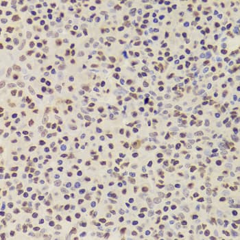 PHAP1 / ANP32A Antibody