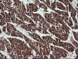 Monoclonal Mouse anti-Human ACAA2 Antibody (clone OTI2F6, IHC, IF, WB)