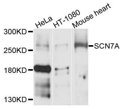 SCN7A Antibody