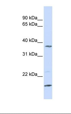 Polyclonal Rabbit anti-Human ZDHHC19 Antibody (N-Terminus, WB)