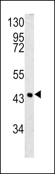 SERPINB3 Antibody (aa40-69)