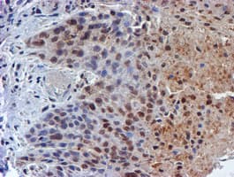 TIP48 / RUVBL2 Antibody (clone OTI1D9)