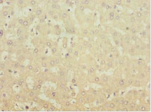 Polyclonal Rabbit anti-Human MGAT / GLYT1 Antibody (IHC)