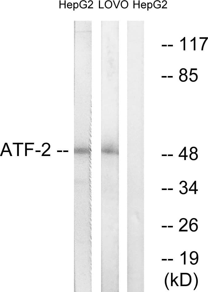 ATF2 Antibody (aa35-84)