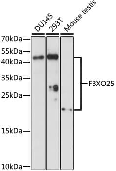 FBXO25 Antibody