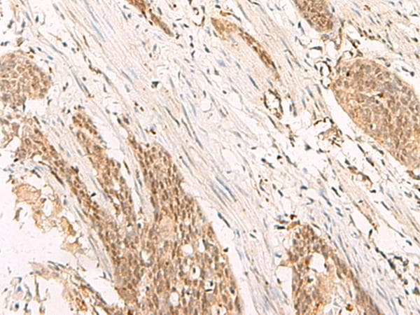 POP4 Antibody