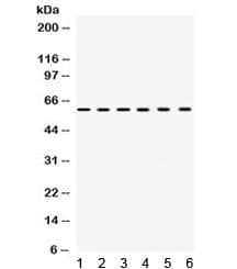 Polyclonal Rabbit anti-Human TCP1 Antibody (IHC, WB)