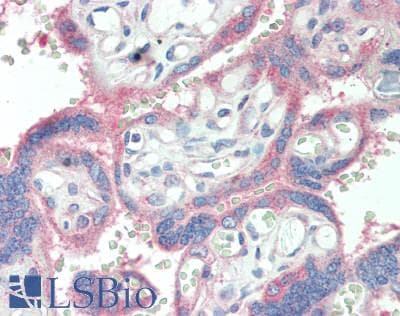 IHC-plus™ Monoclonal Mouse anti-Human AHCYL1 / DCAL Antibody (clone 5D6, IHC, WB)