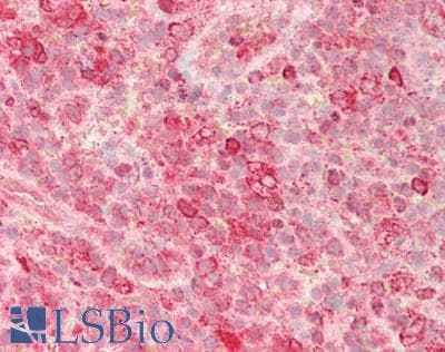 GRN / Granulin Antibody (aa21-120)