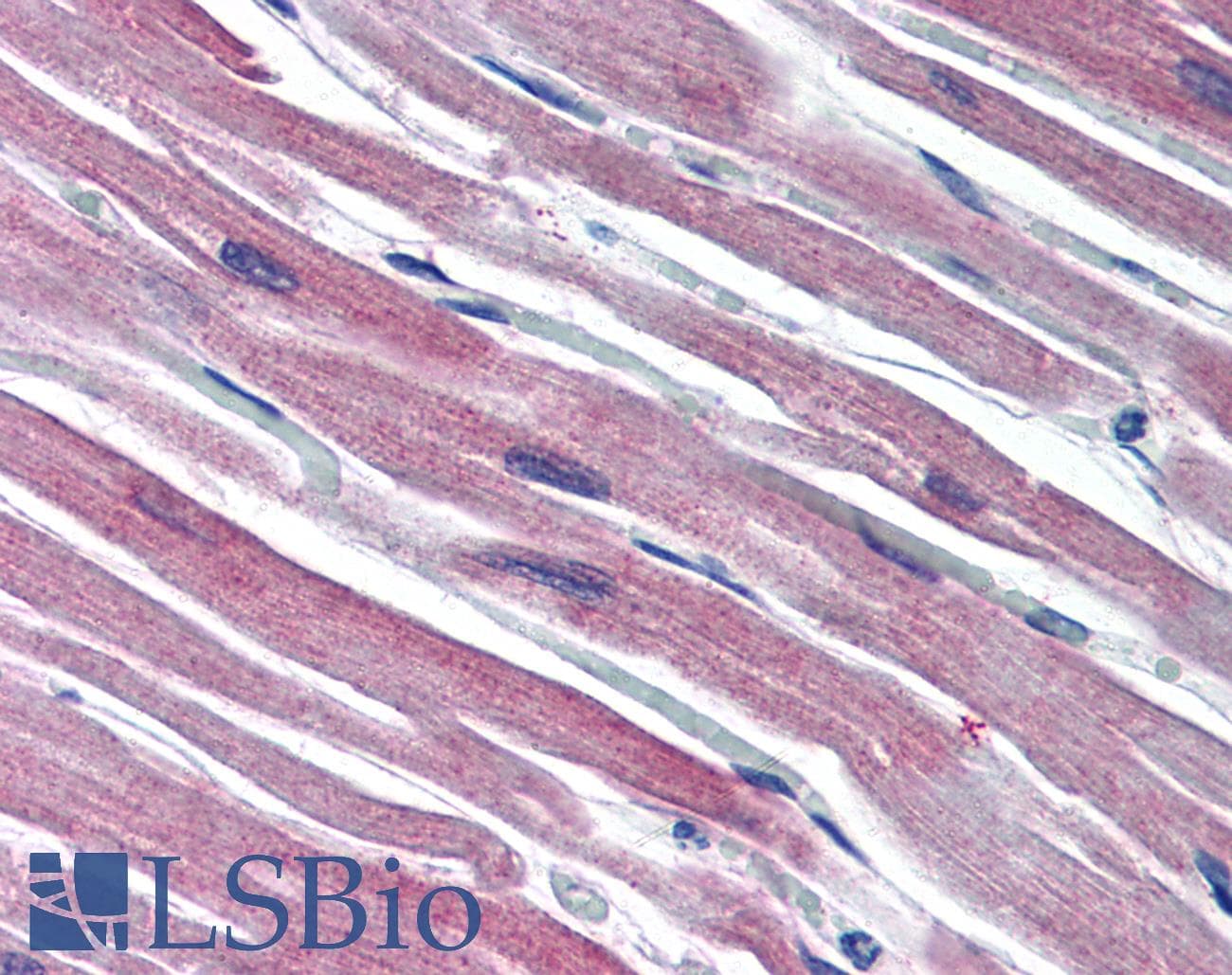 PathPlus™ S100A1 / S100-A1 Antibody (C-Terminus)