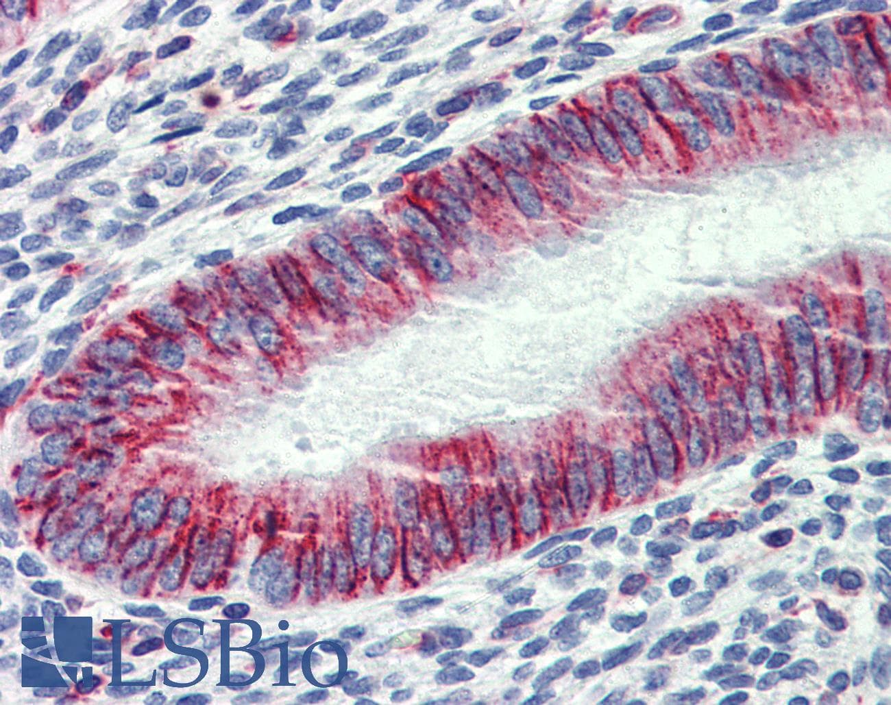 Polyclonal Rabbit anti-Human PHACTR1 Antibody (aa468-517, IHC, WB)