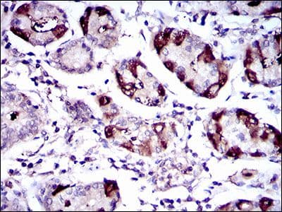 SLC27A5 / BACS Antibody (Amino Acid: 508-570, clone 4B11C10)