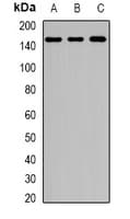 Polyclonal Rabbit anti-Human HUPF2 / UPF2 Antibody (IHC, WB)