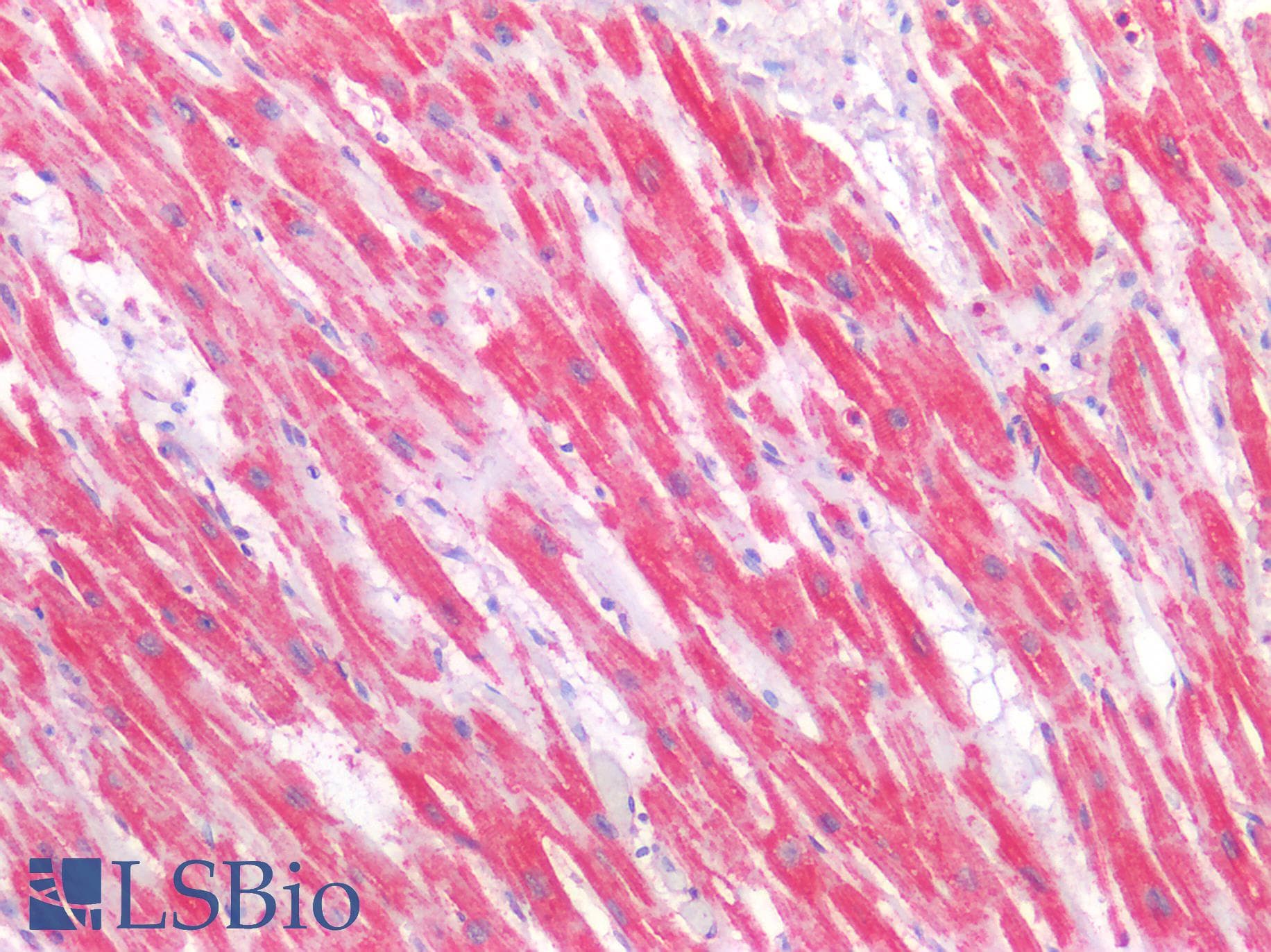 PathPlus™ Polyclonal Rabbit anti-Human SLC16A2 / MCT8 Antibody (Internal, IHC, WB)