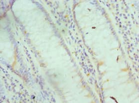 I-BABP / FABP6 Antibody (aa1-128)
