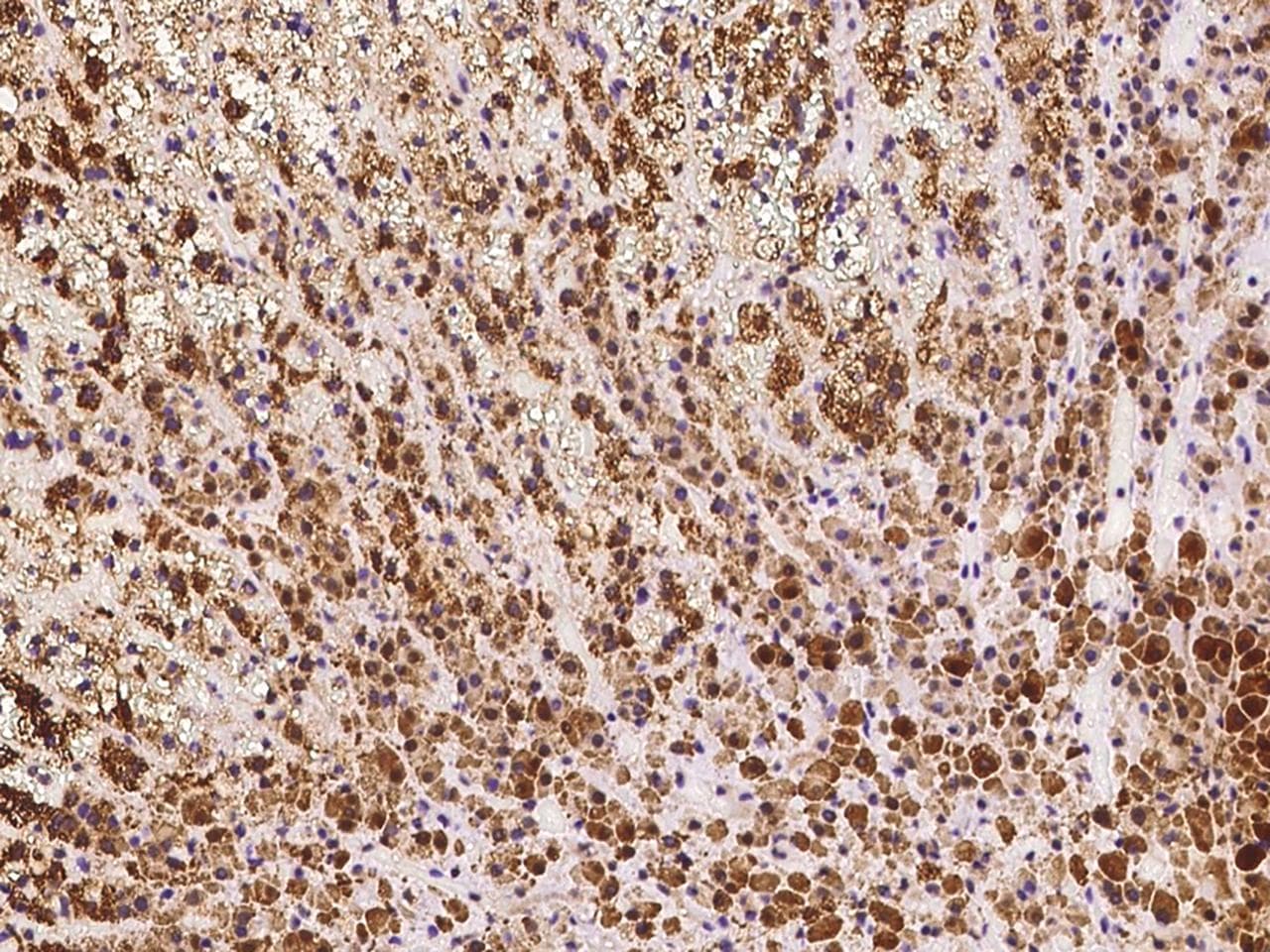 Polyclonal Rabbit anti-Human TRXR1 / TXNRD1 Antibody (IHC)