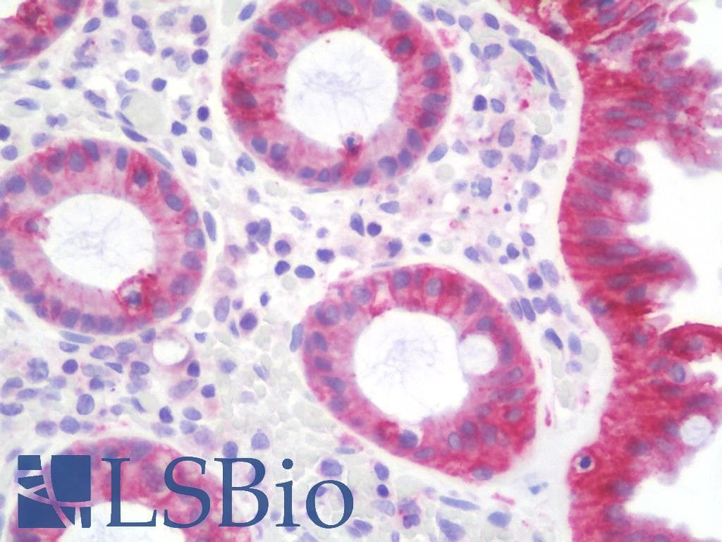 IHC-plus™ JUP/CTNNG/Junction Plakoglobin Antibody