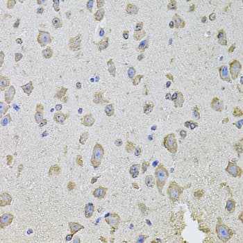 PHF1 Antibody